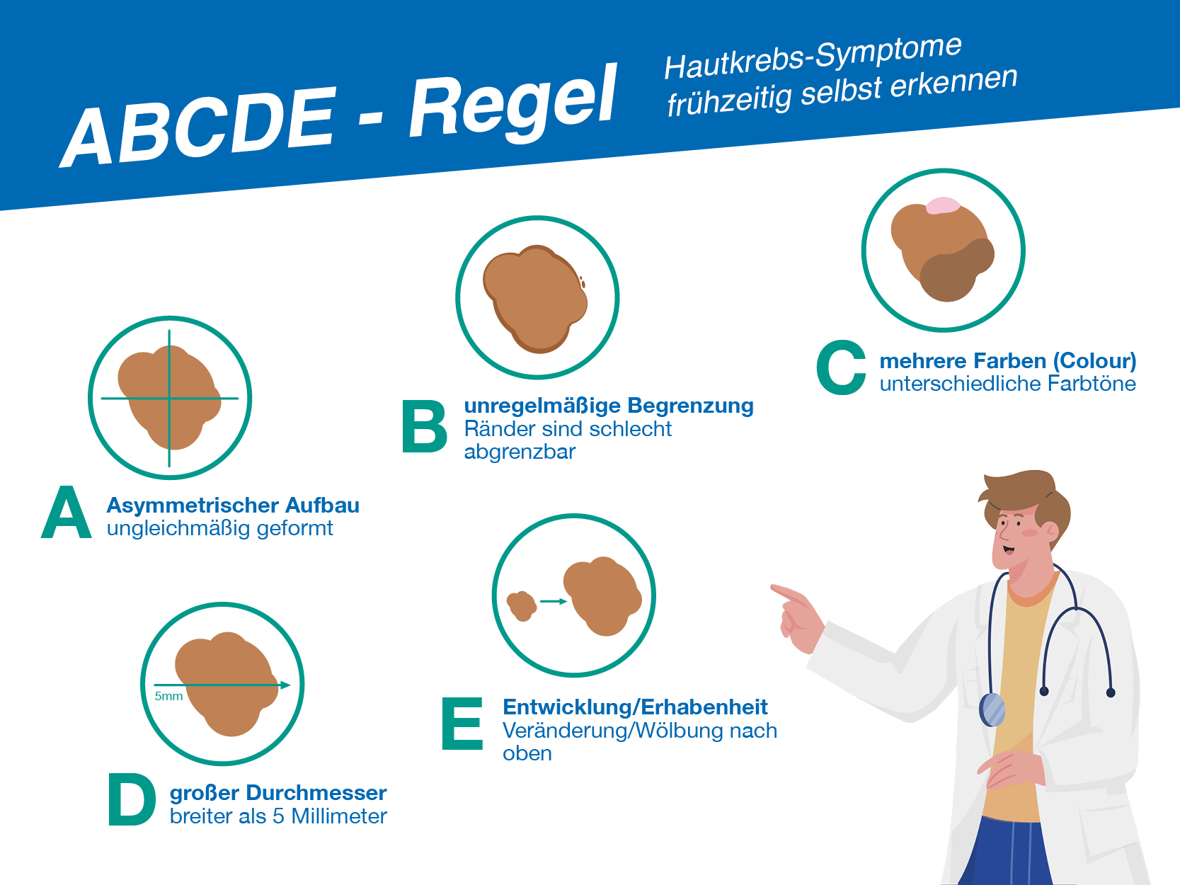 Grafik zur ABCDE-Regel zur frühzeitigen Erkennung von Hautkrebs-Symptomen. Sie zeigt fünf Merkmale verdächtiger Hautveränderungen:A: Asymmetrischer Aufbau (ungleichmäßige Form), B: Unregelmäßige Begrenzung (schlecht abgrenzbare Ränder), C: Mehrere Farben (unterschiedliche Farbtöne), D: Großer Durchmesser (breiter als 5 mm),
E: Entwicklung/Erhabenheit (Veränderung oder Wölbung nach oben). Rechts unten ein gezeichneter Arzt mit Stethoskop, der auf die Merkmale zeigt.